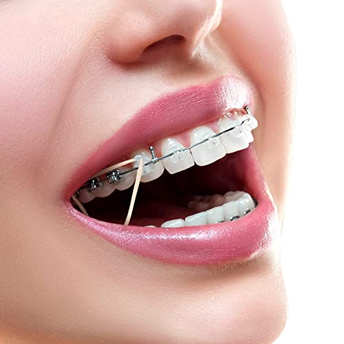 500 парчиња Ортодонтски еластични гумени ленти, заби за заби на гумен влечен лента со 5 парчиња еластични плакери